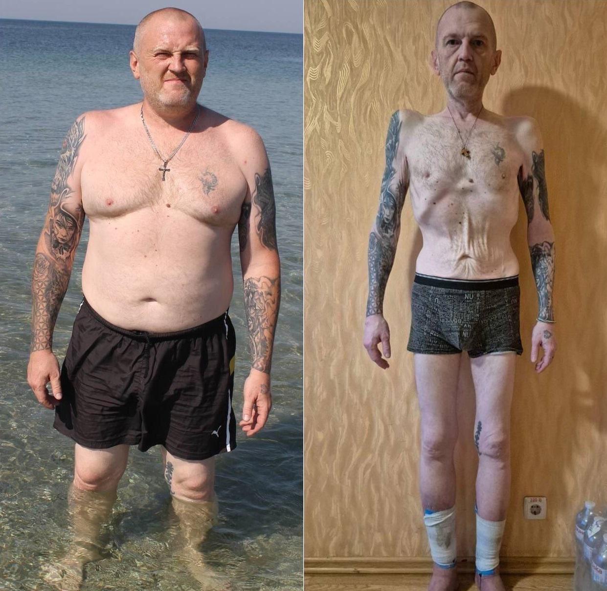 Ukrainian defender before and after Russian captivity