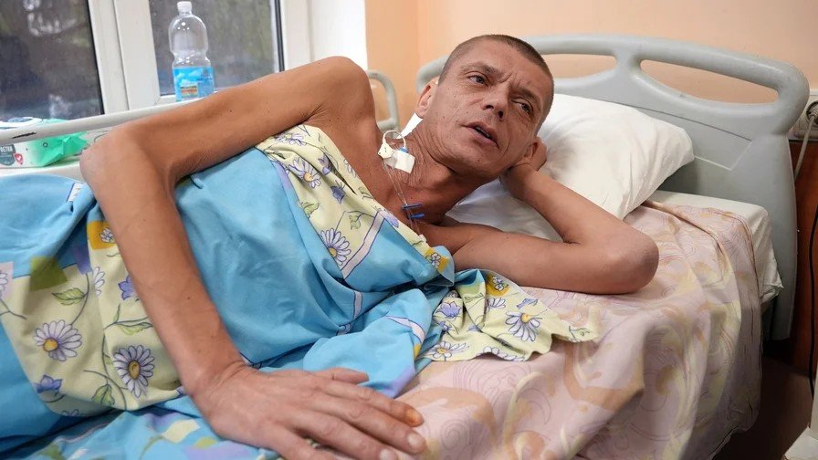 Soldier with tourniquet for 36 days operated on in Kharkiv hospital