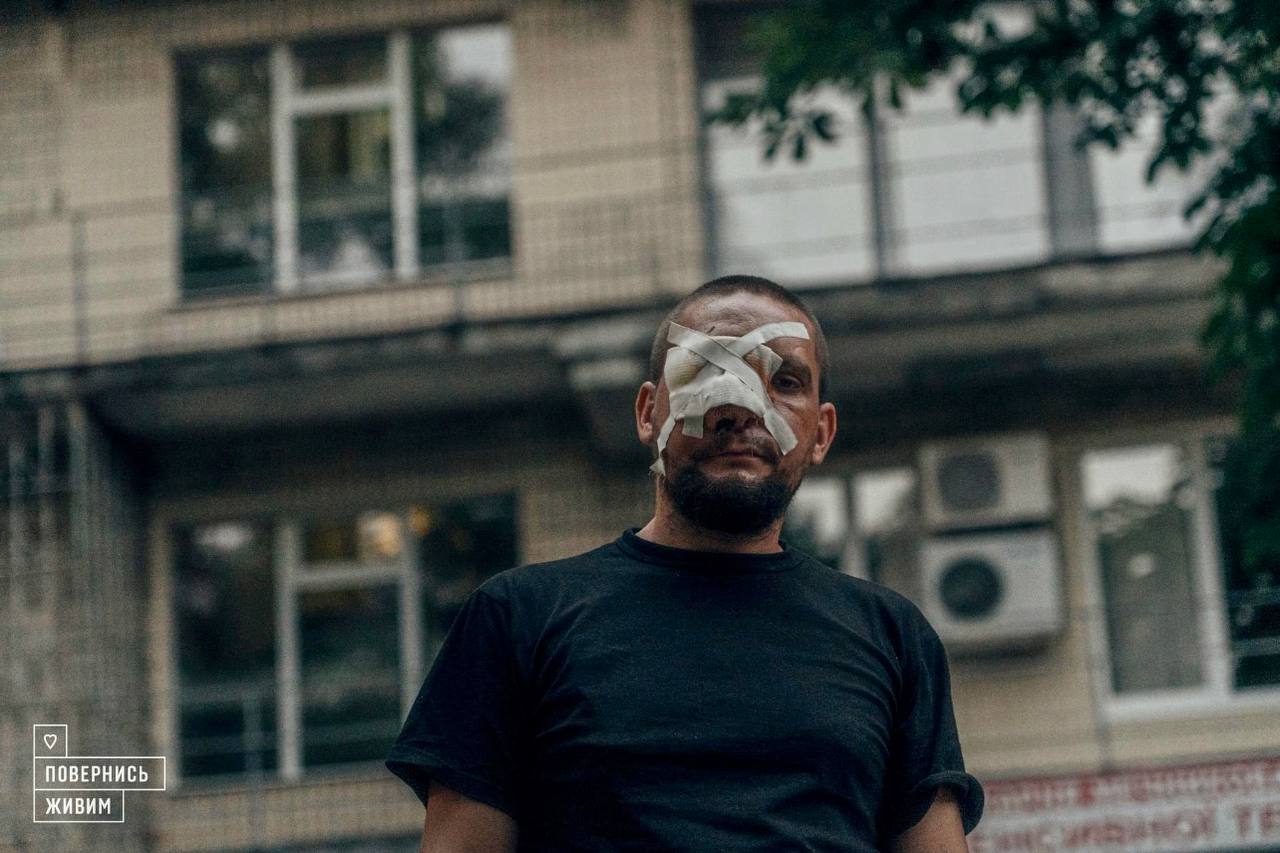 Soldier wounded in Donetsk needs surgeries for facial reconstruction and breathing restoration.