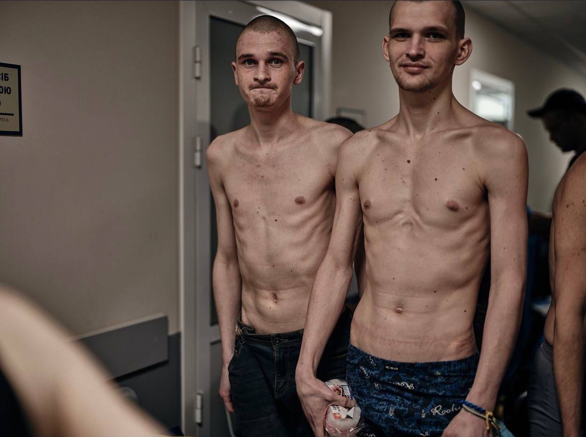 More Ukrainian prisoners freed resemble camp inmates