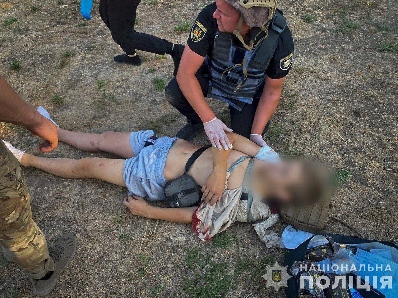 Invaders hit cafe in Zaporizhzhia: five wounded, four children
