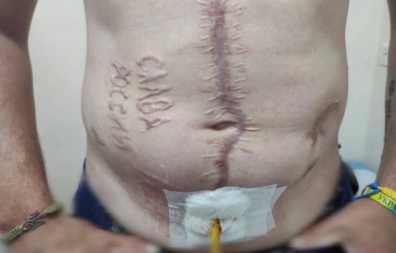 Photo with inscription Glory to Russia on liberated warrior’s body
