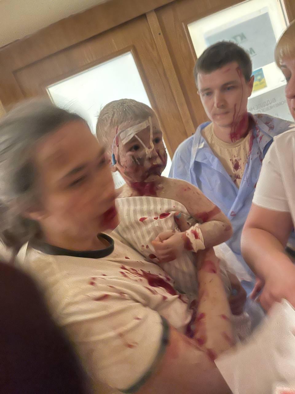 Russian rockets hit Kyiv Children’s Hospital on July 8
