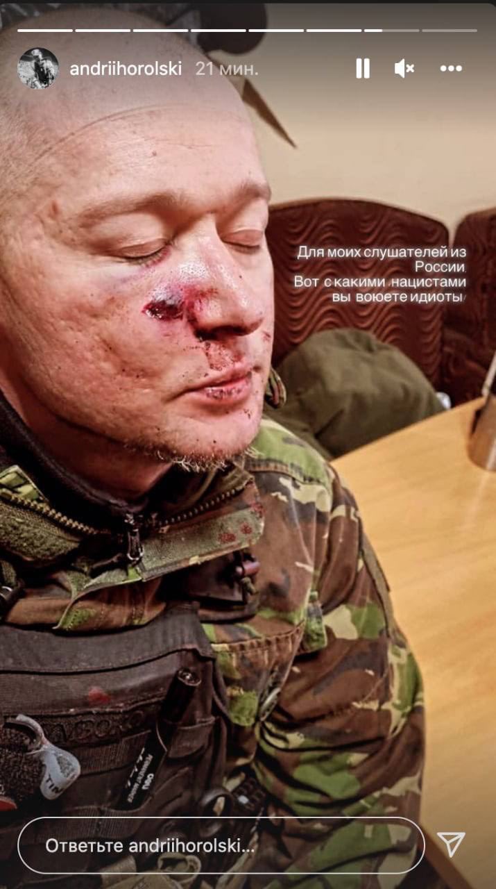 Ukrainian band Boombox frontman injured, calls Russian soldiers Nazis