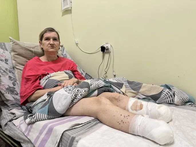 Drone targets feet: attacks on civilians in Kherson