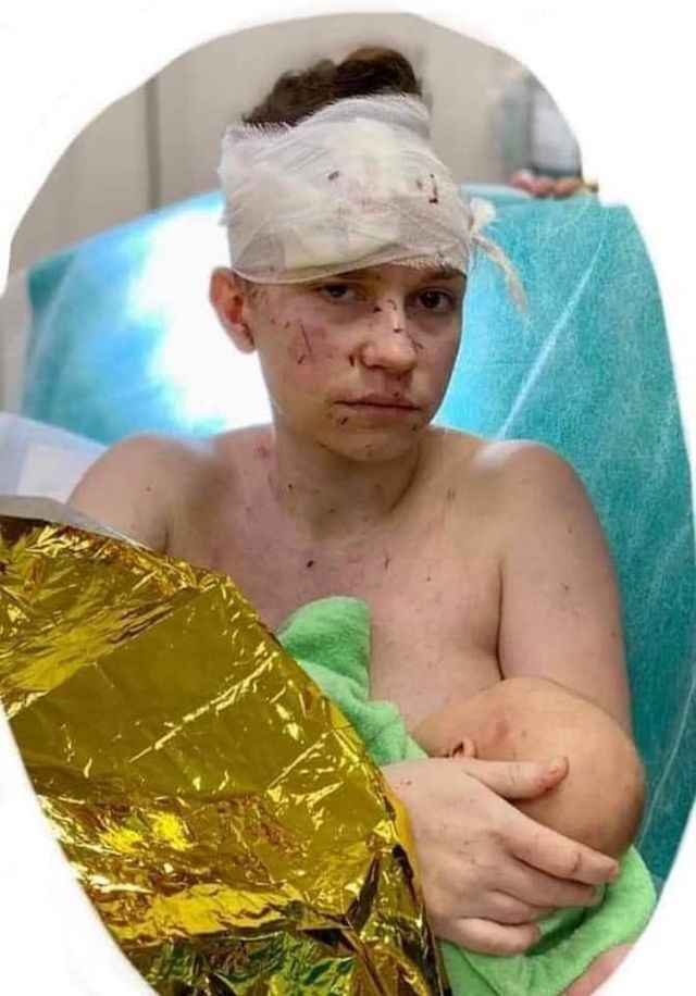 Ukrainian Madonna: Mother shields baby, receives 24 wounds, child unharmed