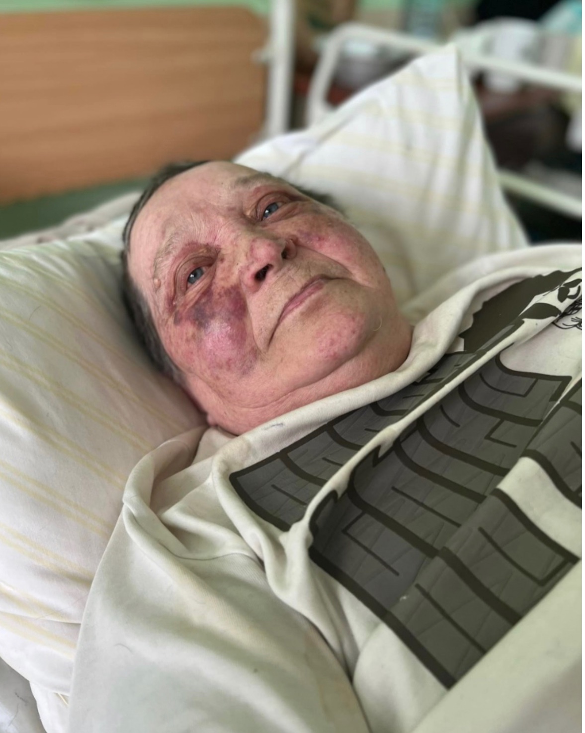 Russians attack 70-year-old journalist in Kherson