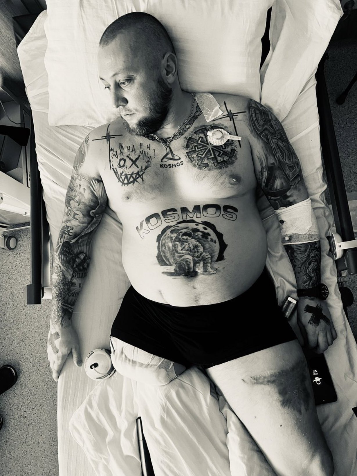 Ukrainian defender needs surgery help