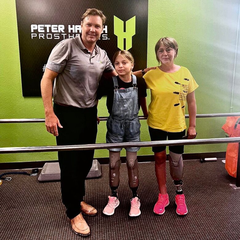 Stepanenko family undergoes prosthetics in California