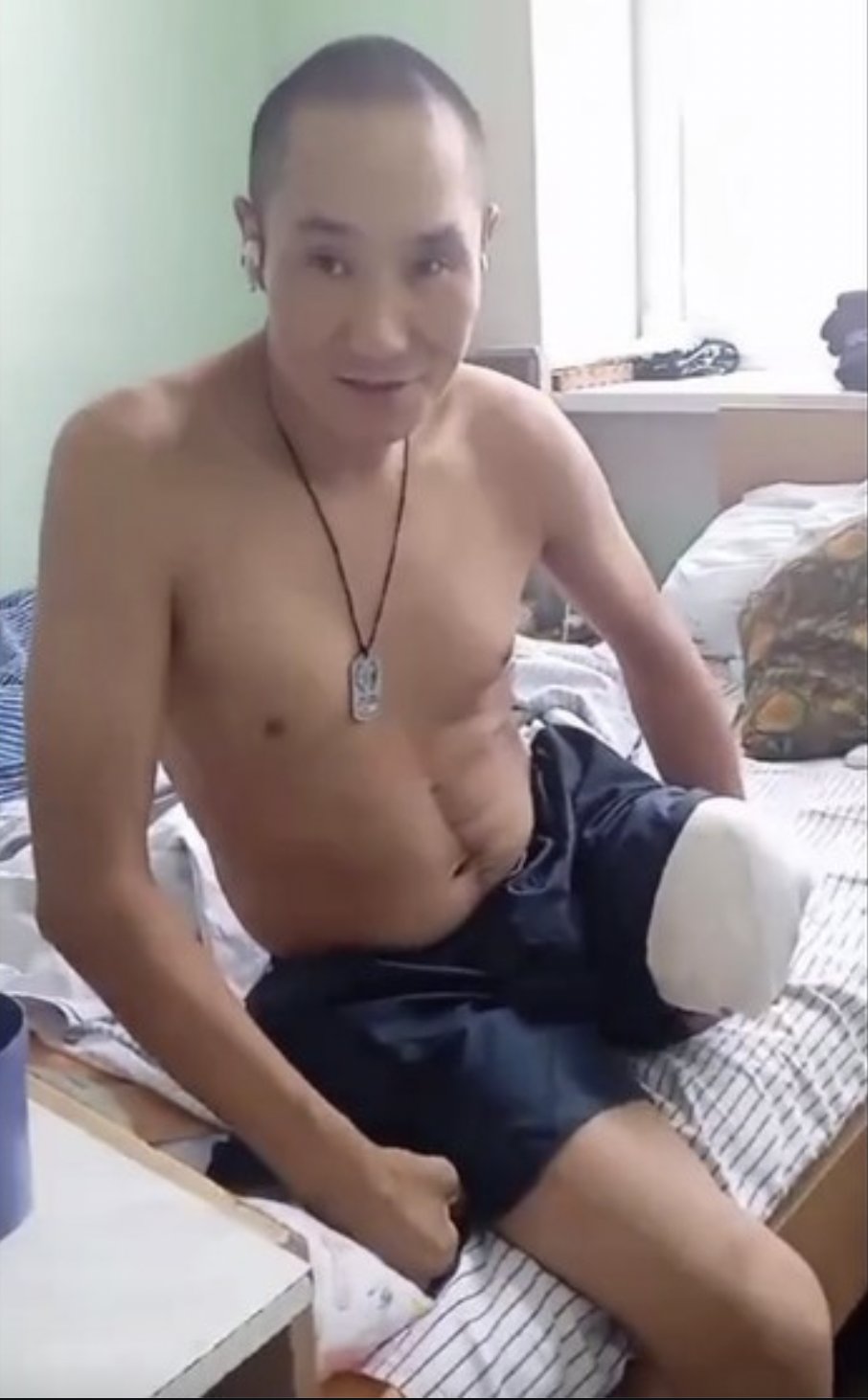 Yakut soldier amputates own leg due to lack of medical care on front lines