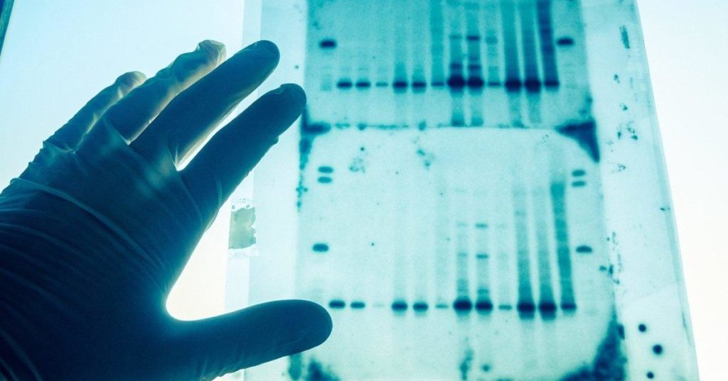 Ukraine Establishes DNA Registry