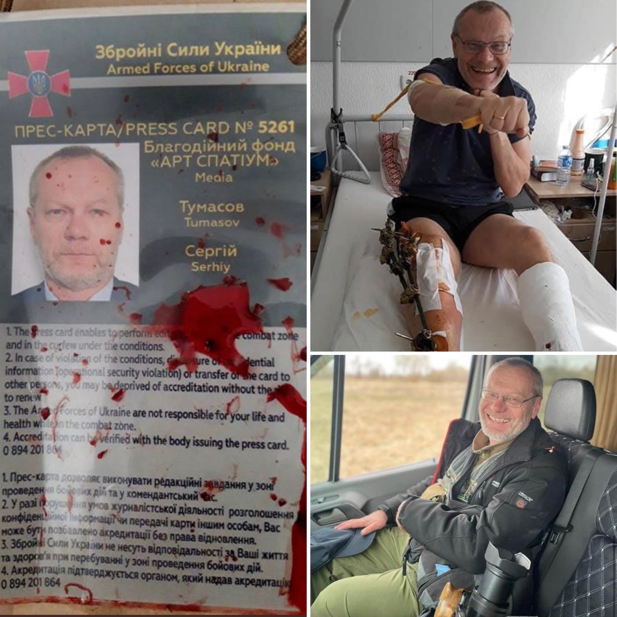 Photojournalist Sergiy Tumasov wounded by shelling
