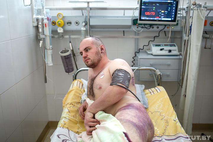 Monstrous Cruelty: Denial of Police Violence in Belarus