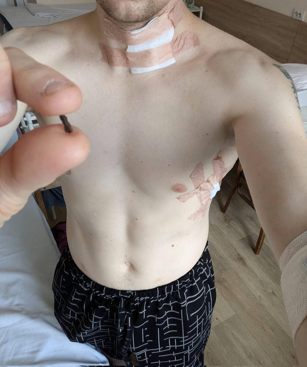 Journalist Asyev wounded at front