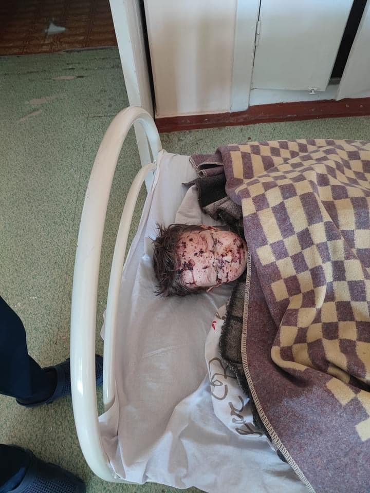 Woman and twins injured in Severodonetsk shelling