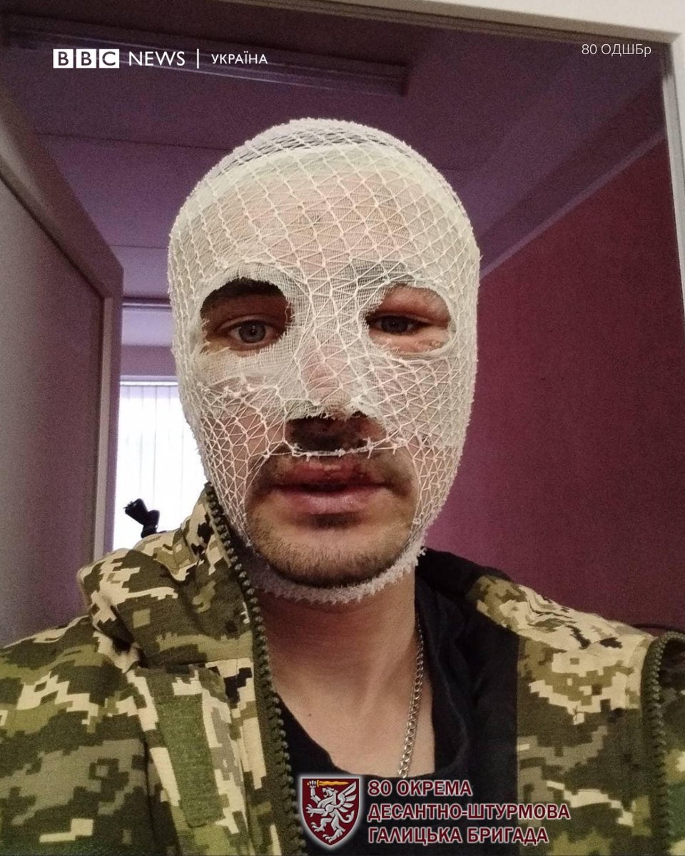 Ukrainian Paratrooper ‘Psycho’ Escapes Russian Captivity Twice, Turns Captivity into Victory
