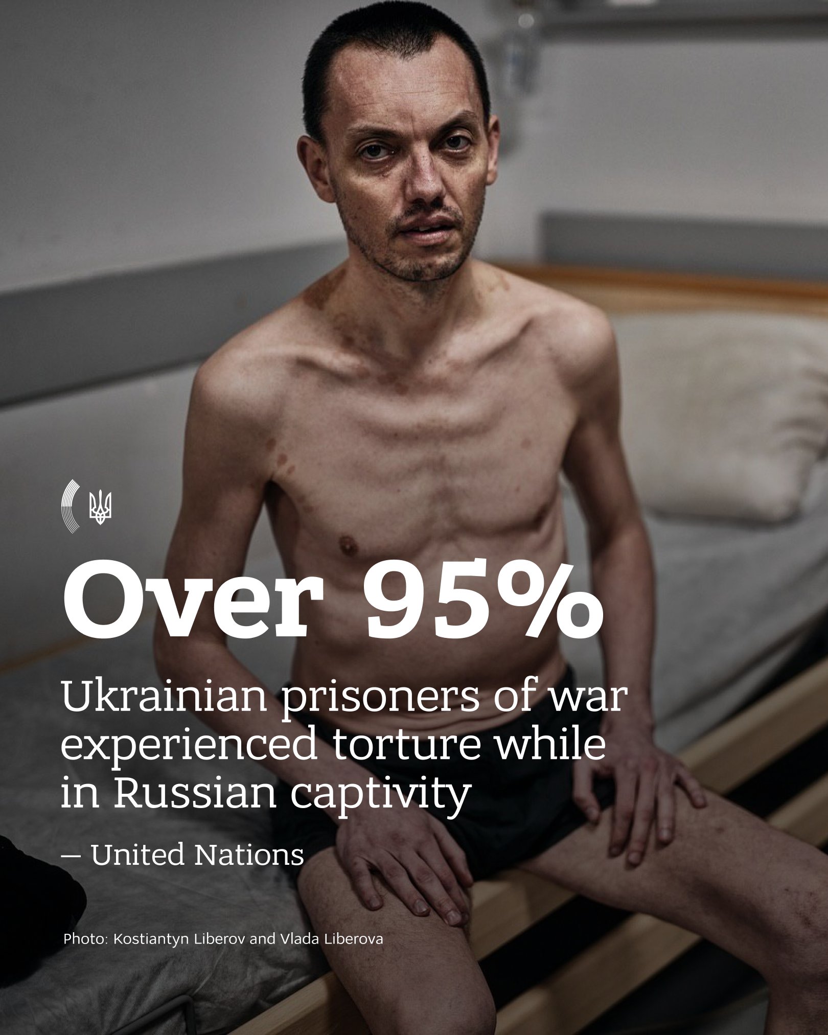UN mission: Russian captivity tortures Ukrainian defenders as war crime