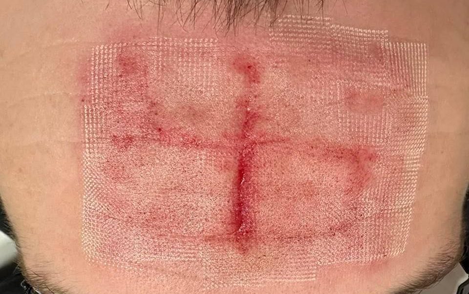 Russian soldiers carved swastikas into Ukrainian POWs’ foreheads