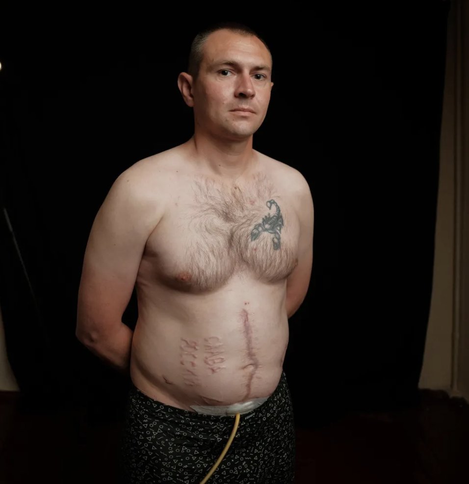 Russian detention centers use ‘gentleman’s kit’ torture