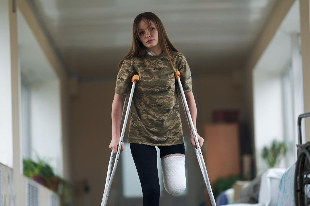 Ukrainian volunteer Ruslana loses leg, continues fighting for future