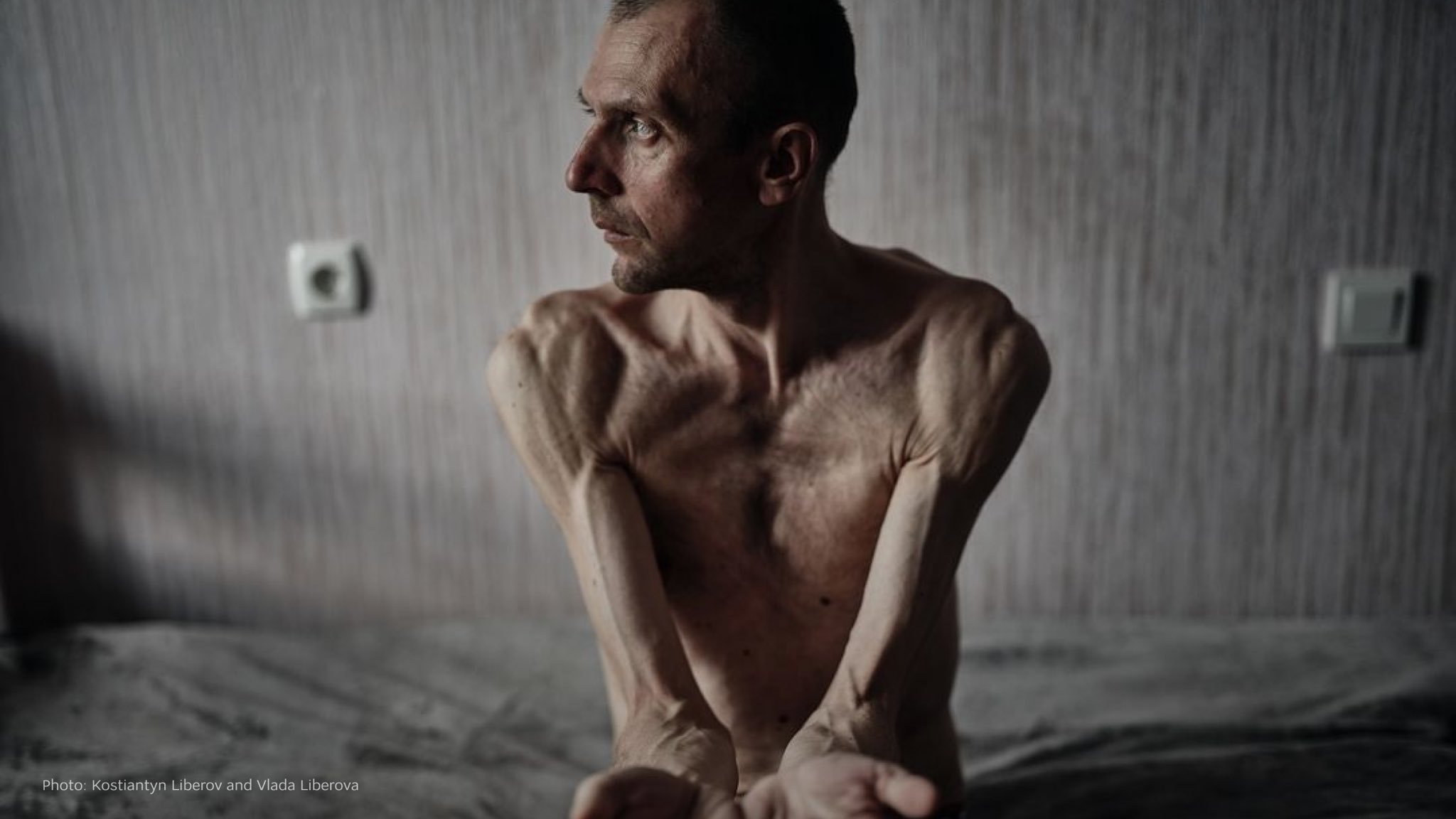 Photos of freed Ukrainians prove Russia’s inhumane POW conditions