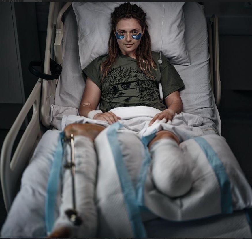 Wounded UAV operator Ada to return to service after rehabilitation