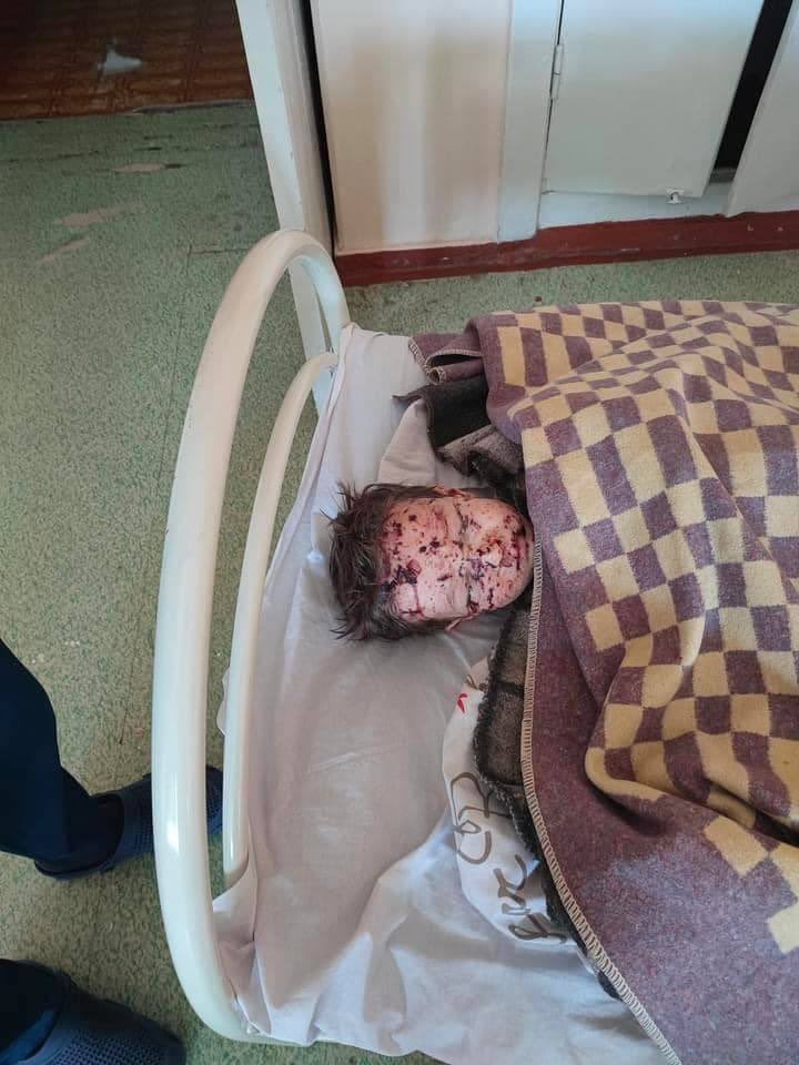 Twins and their mother wounded by Russian bombardment at hospital