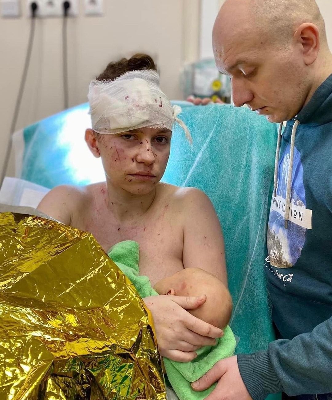 Ukrainian Madonna shields baby from shelling, receives 24 wounds