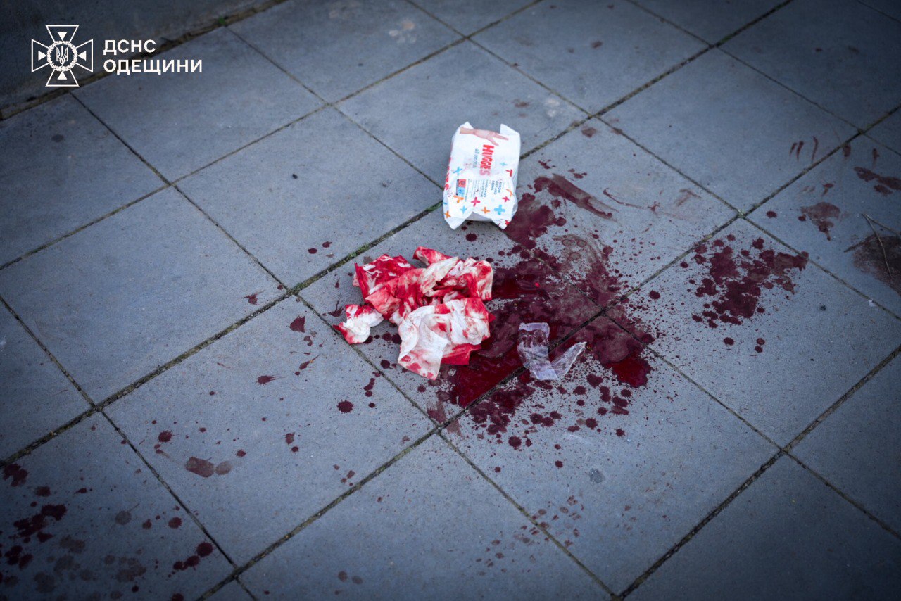 4-year-old Zlata dies from Russian shelling in Odesa
