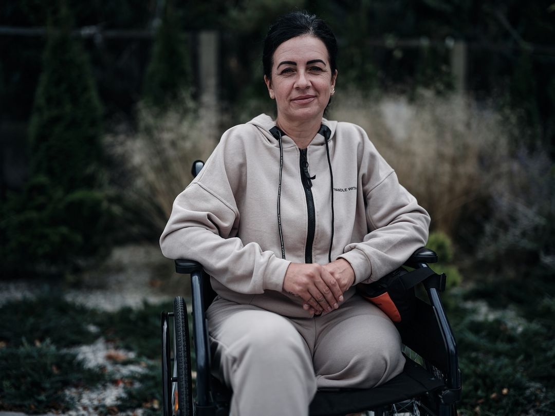 Ukrainian baker injured by Russian missile while going to mother’s birthday