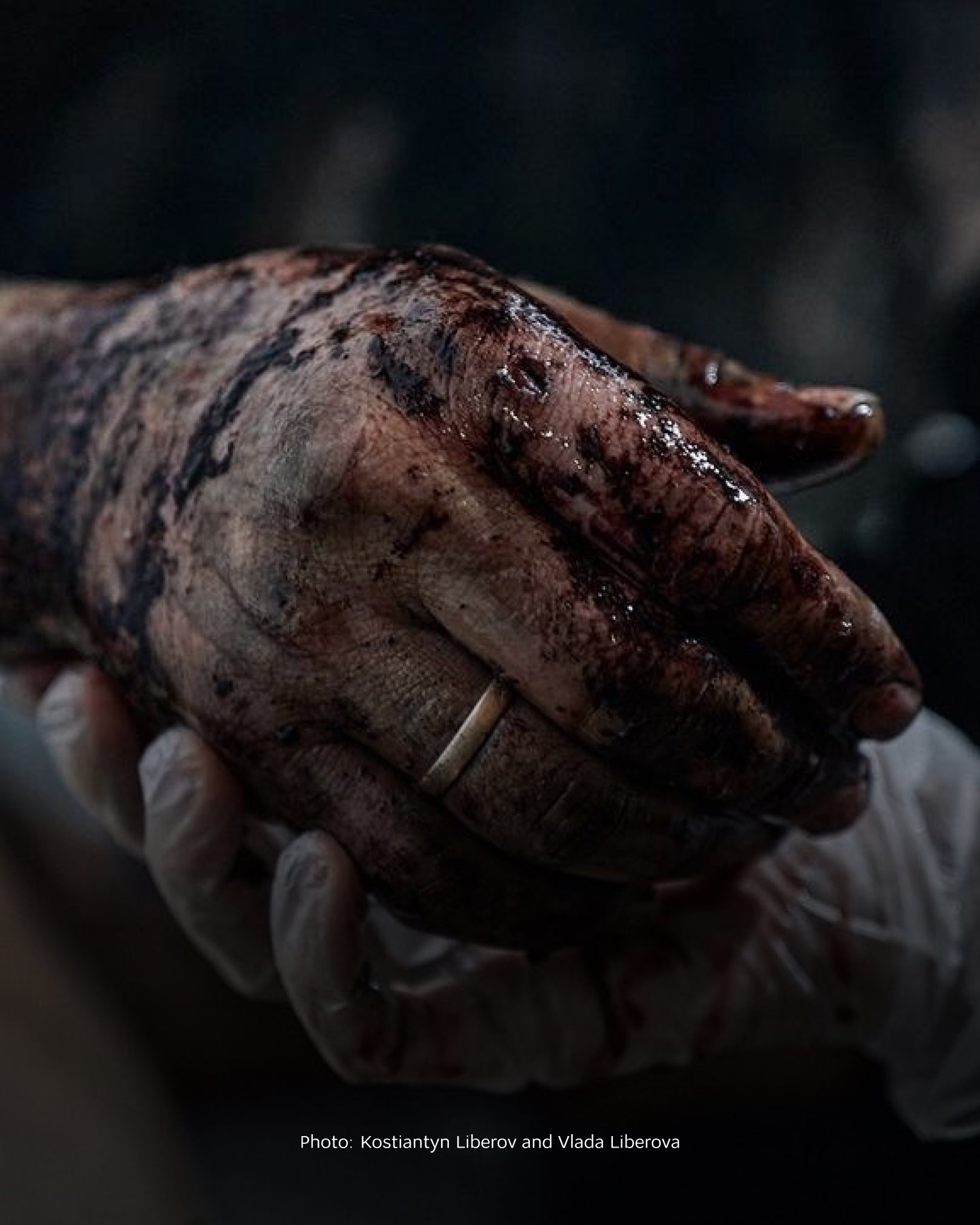 Ukrainian defenders pay the price of freedom against Russia