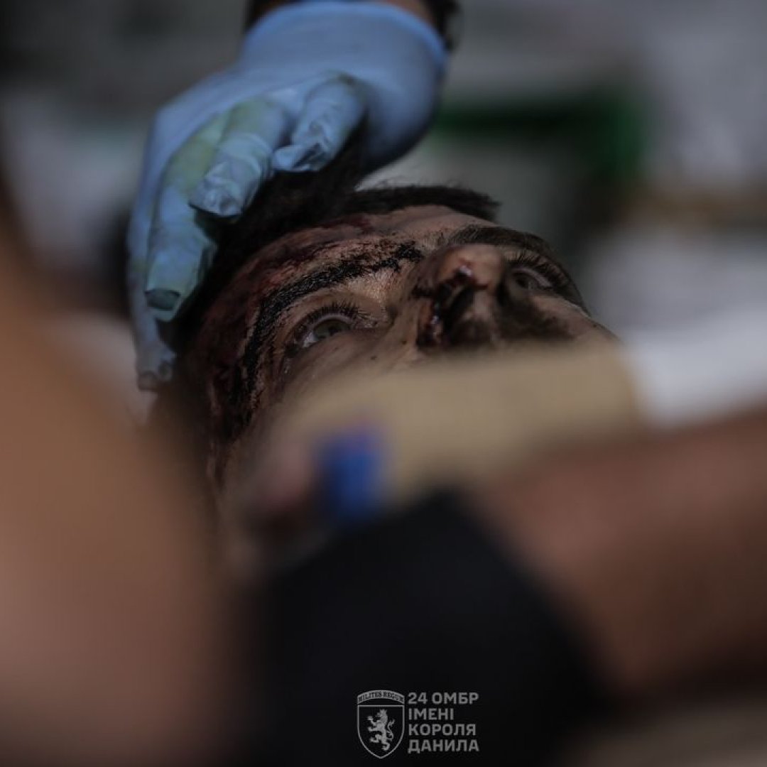 Ukrainian doctors save soldiers fighting for global peace