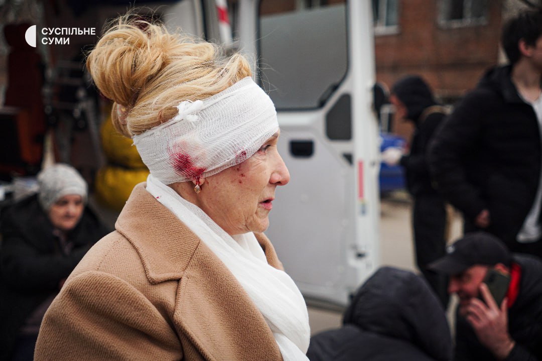 Russian missile attack on Sumy injures 106, including 23 children