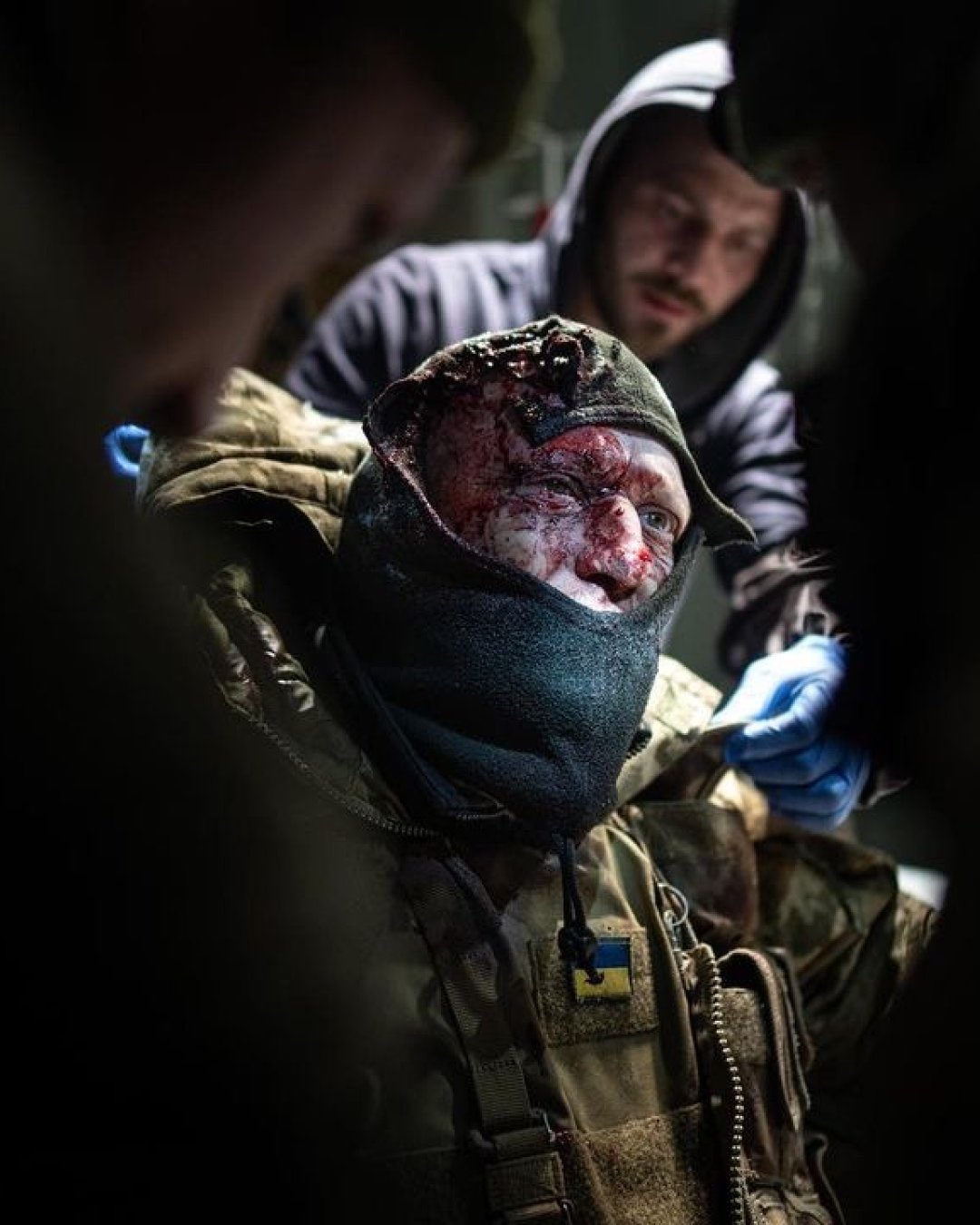 Wounded Ukrainian defender receives medical aid near Bakhmut