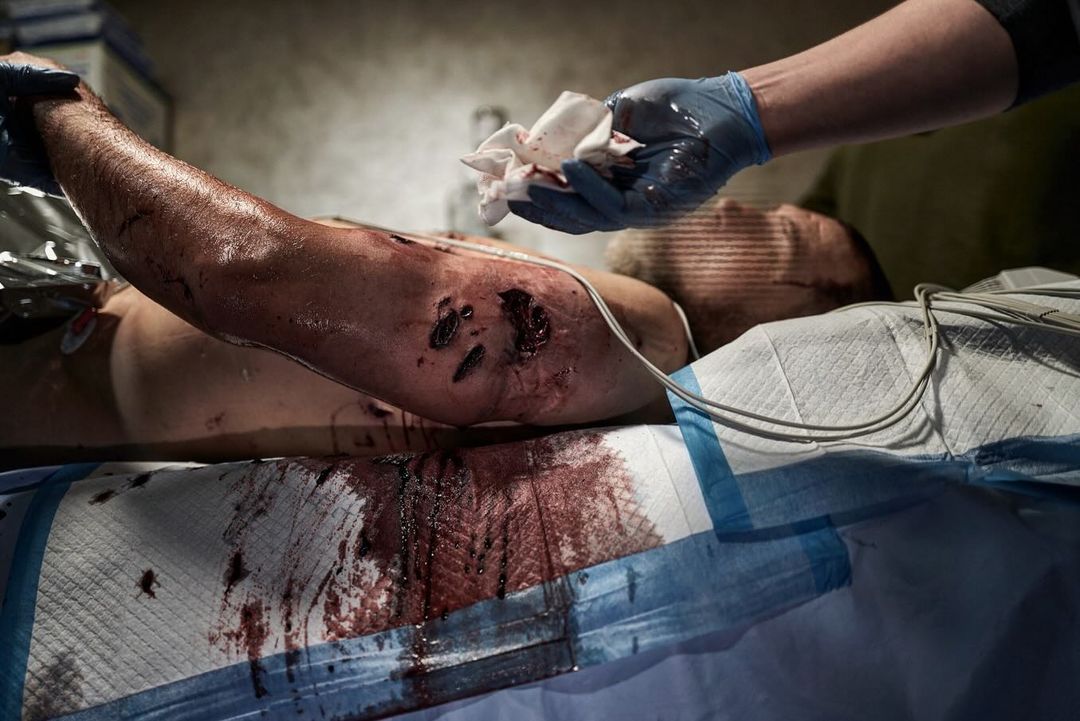 Int’l Legion Medical Teams Save Lives Amid Intense Combat in Ukraine