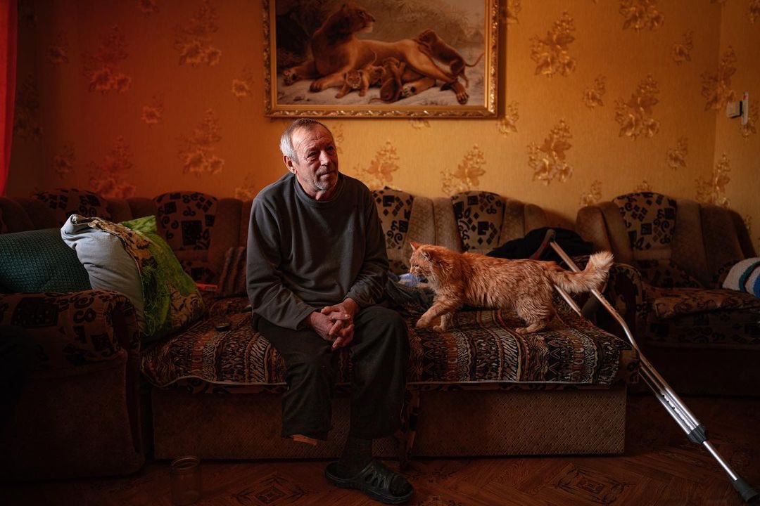 66-year-old Oleksandr loses leg to Russian ‘petal’ mine in Izium