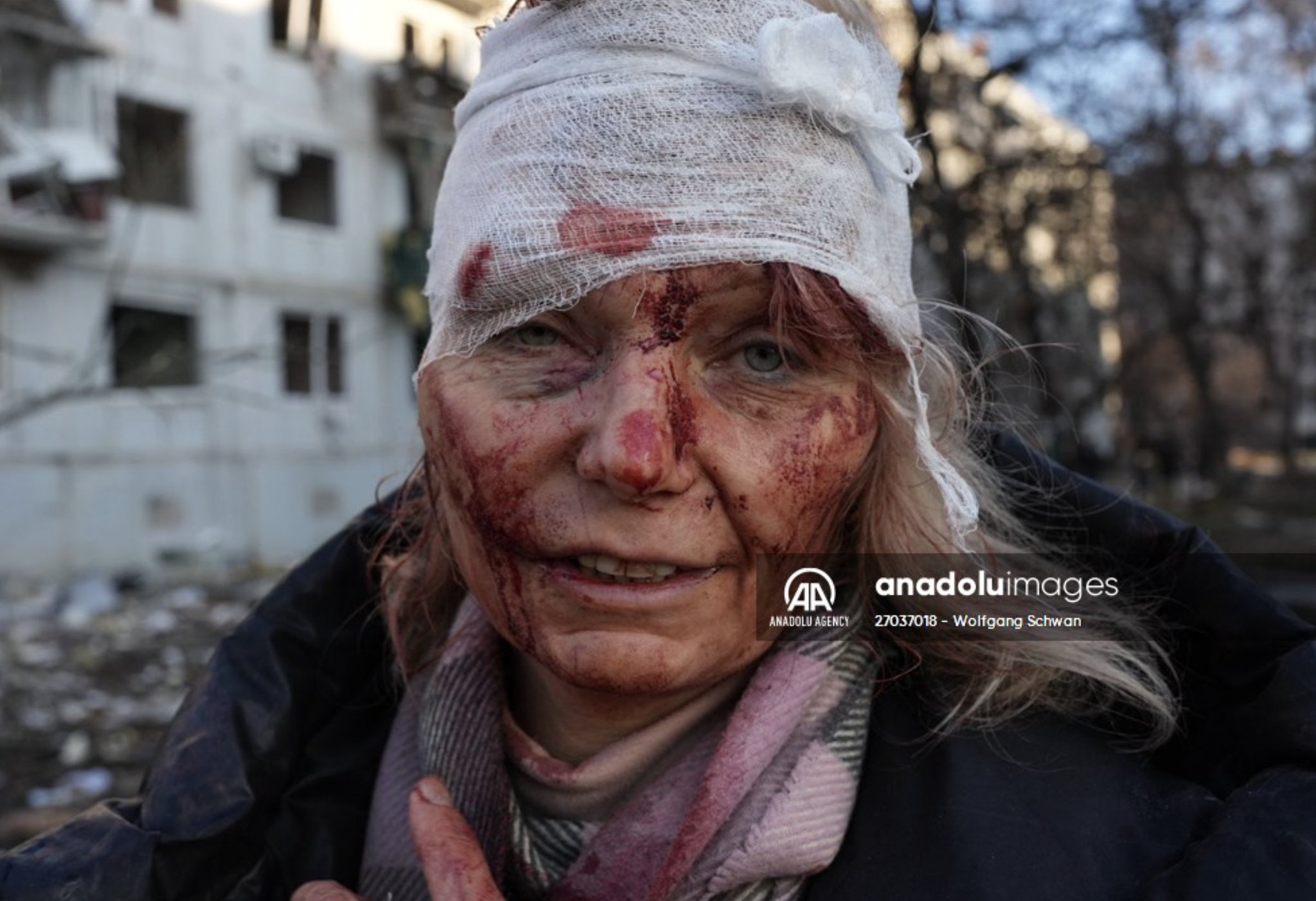 Wounded civilian from Chuhuiv attack survives, now homeless and trapped.