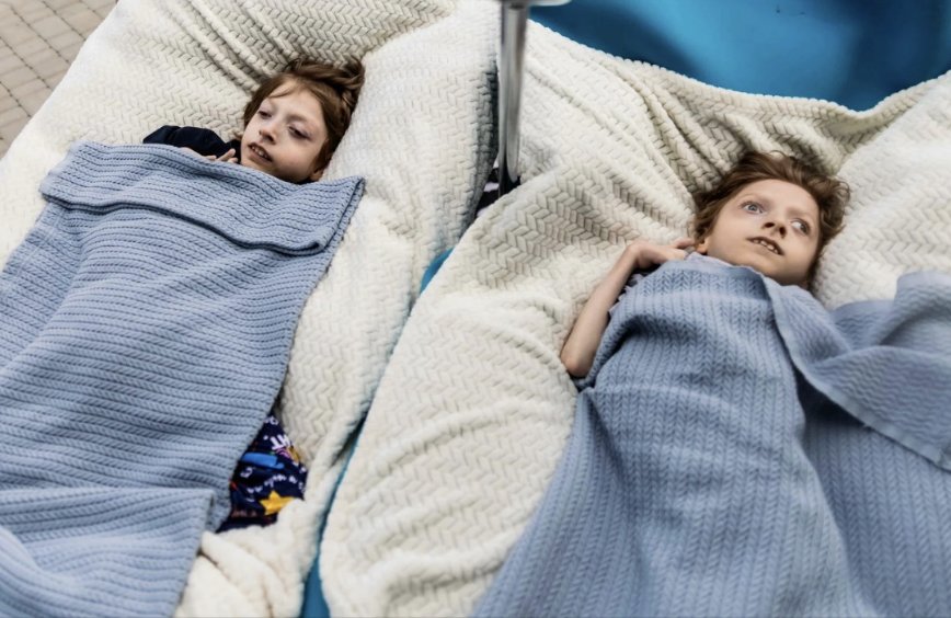 13-year-old brothers, 8.5 kg, bedridden in Pokrovsk, cared for by 10-year-old brother